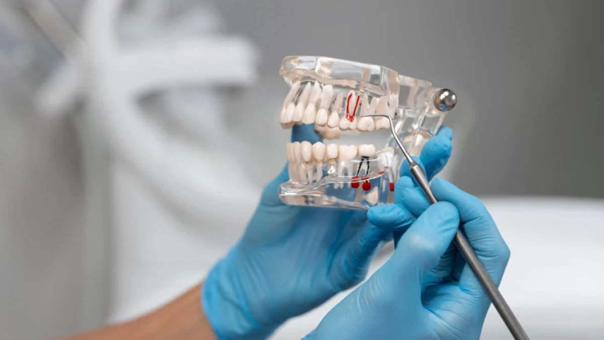 Diş implantları hakkında bilmeniz gereken 9 önemli bilgi!